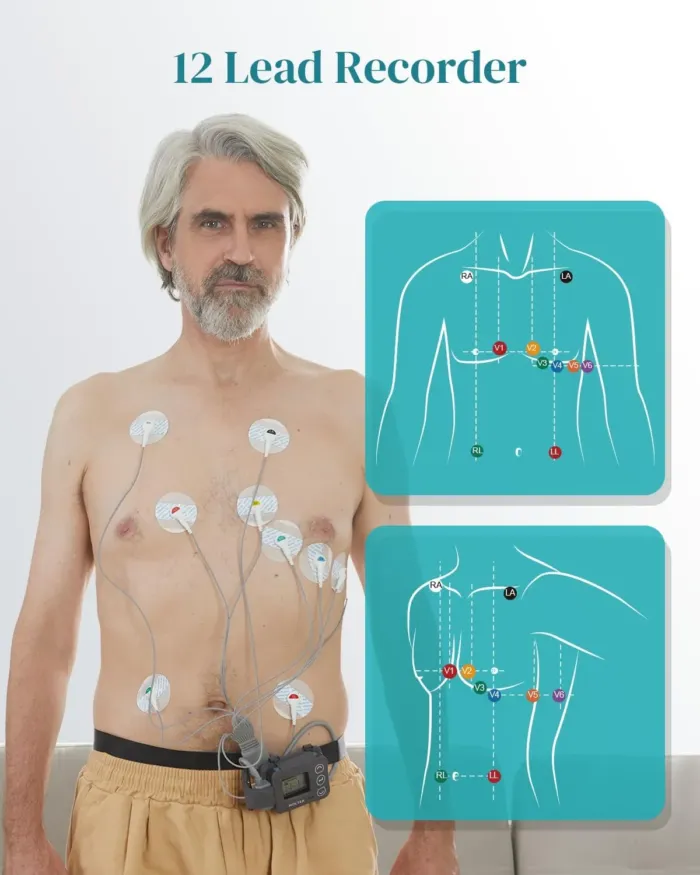 Portable 12-Lead Heart Monitor with AI Analysis for Home Use, 24 Hours Recording, Stand-Alone Machine with LCD Screen, Software Compatible with Mac & Windows, TH12 - Image 5