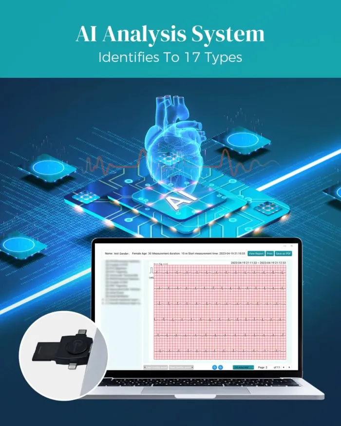 Portable 12-Lead Heart Monitor with AI Analysis for Home Use, 24 Hours Recording, Stand-Alone Machine with LCD Screen, Software Compatible with Mac & Windows, TH12 - Image 6