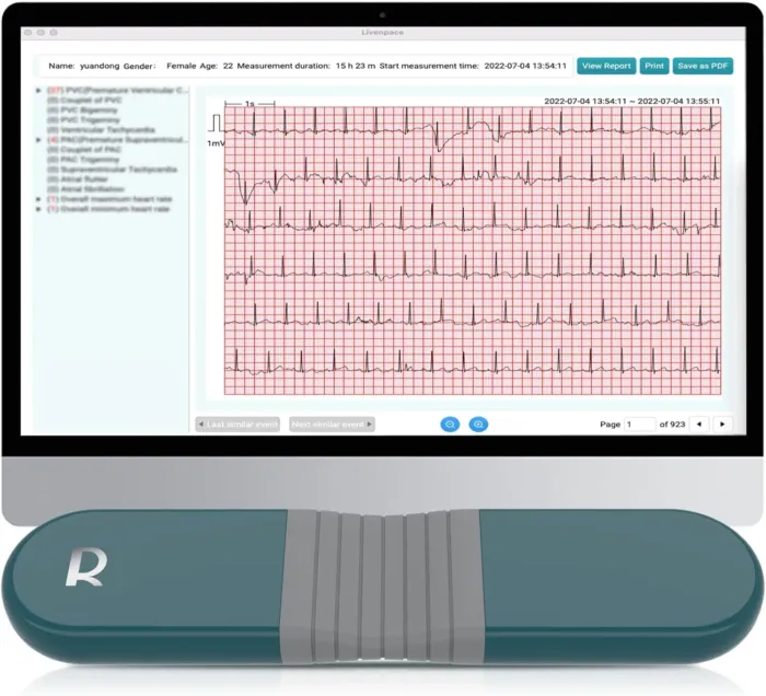 AI HR Monitor, 24 Hours Chest Lead Device with Free AI Analysis & PC Report, Chargeable Recorder, HHM1 - Image 2