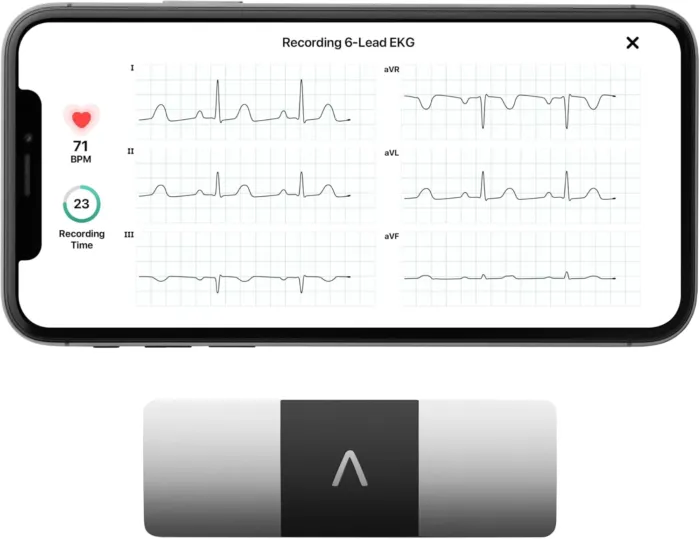 KardiaMobile 6-Lead Personal EKG Monitor – Six Views of The Heart – Detects AFib and Irregular Arrhythmias – Instant Results in 30 Seconds – Works with Most Smartphones - FSA/HSA Eligible - Image 2